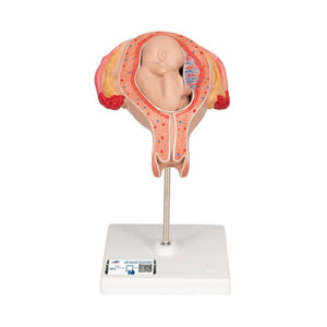 3B 5th Month Fetus Breech Position