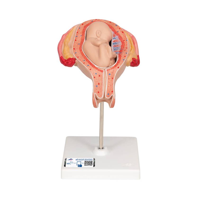 3B 5th Month Fetus Breech Position