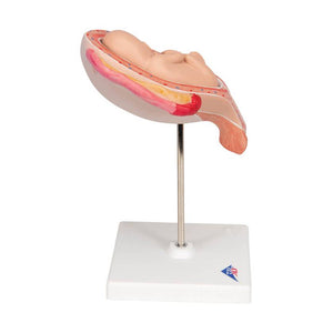 3B 5th Month Fetus Breech Position