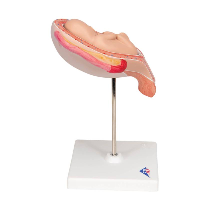 3B 5th Month Fetus Breech Position