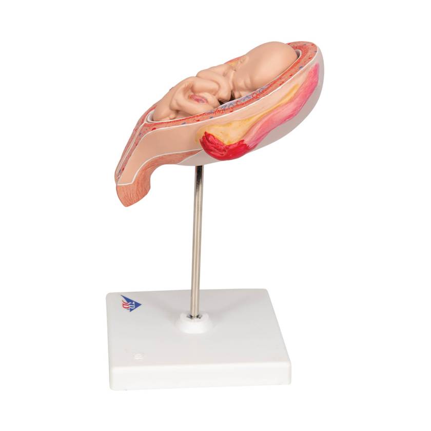 3B 5th Month Fetus Breech Position