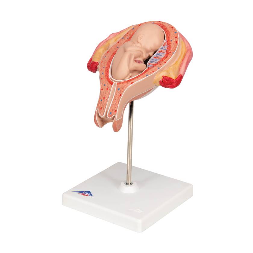 3B 5th Month Fetus Breech Position