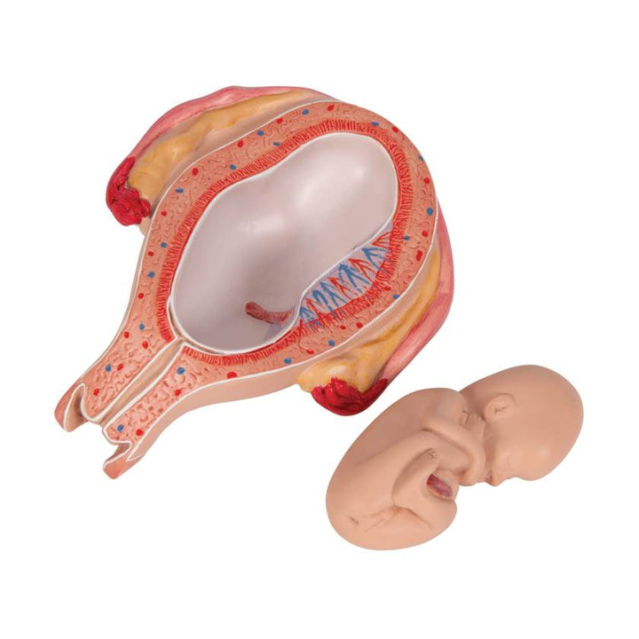 3B 5th Month Fetus Breech Position