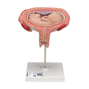 3B 5th Month Fetus Transverse Lie
