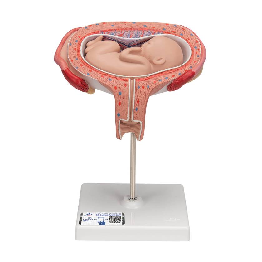 3B 5th Month Fetus Transverse Lie