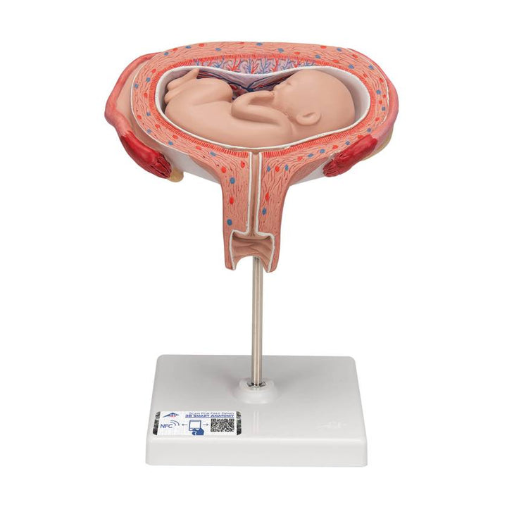3B 5th Month Fetus Transverse Lie