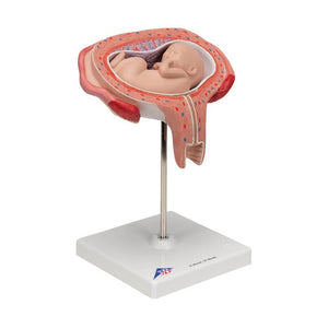3B 5th Month Fetus Transverse Lie