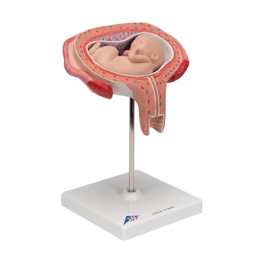 3B 5th Month Fetus Transverse Lie