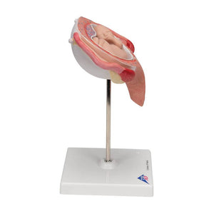 3B 5th Month Fetus Transverse Lie