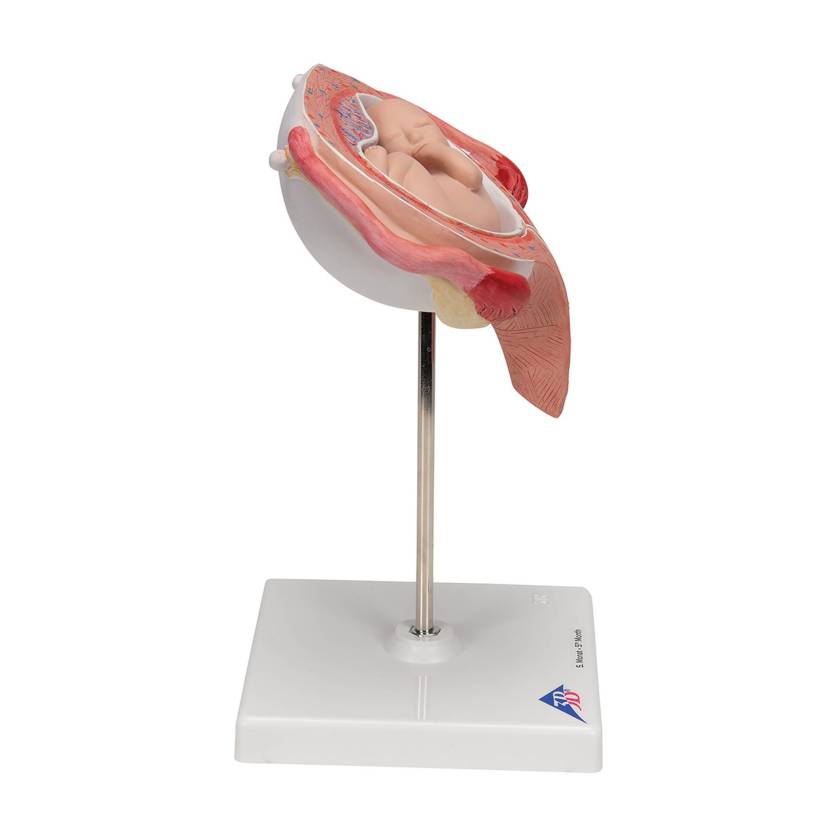 3B 5th Month Fetus Transverse Lie