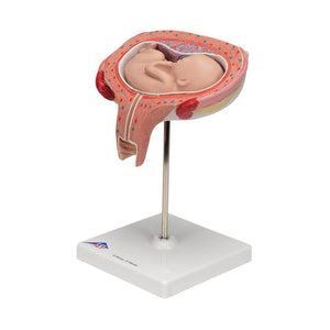 3B 5th Month Fetus Transverse Lie