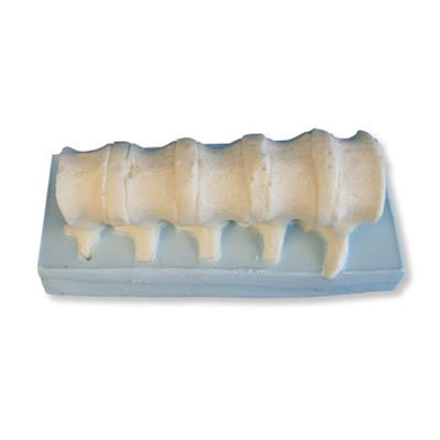 3B Ligametum Flavum Vertebral  Bones and Intraspinal Ligament