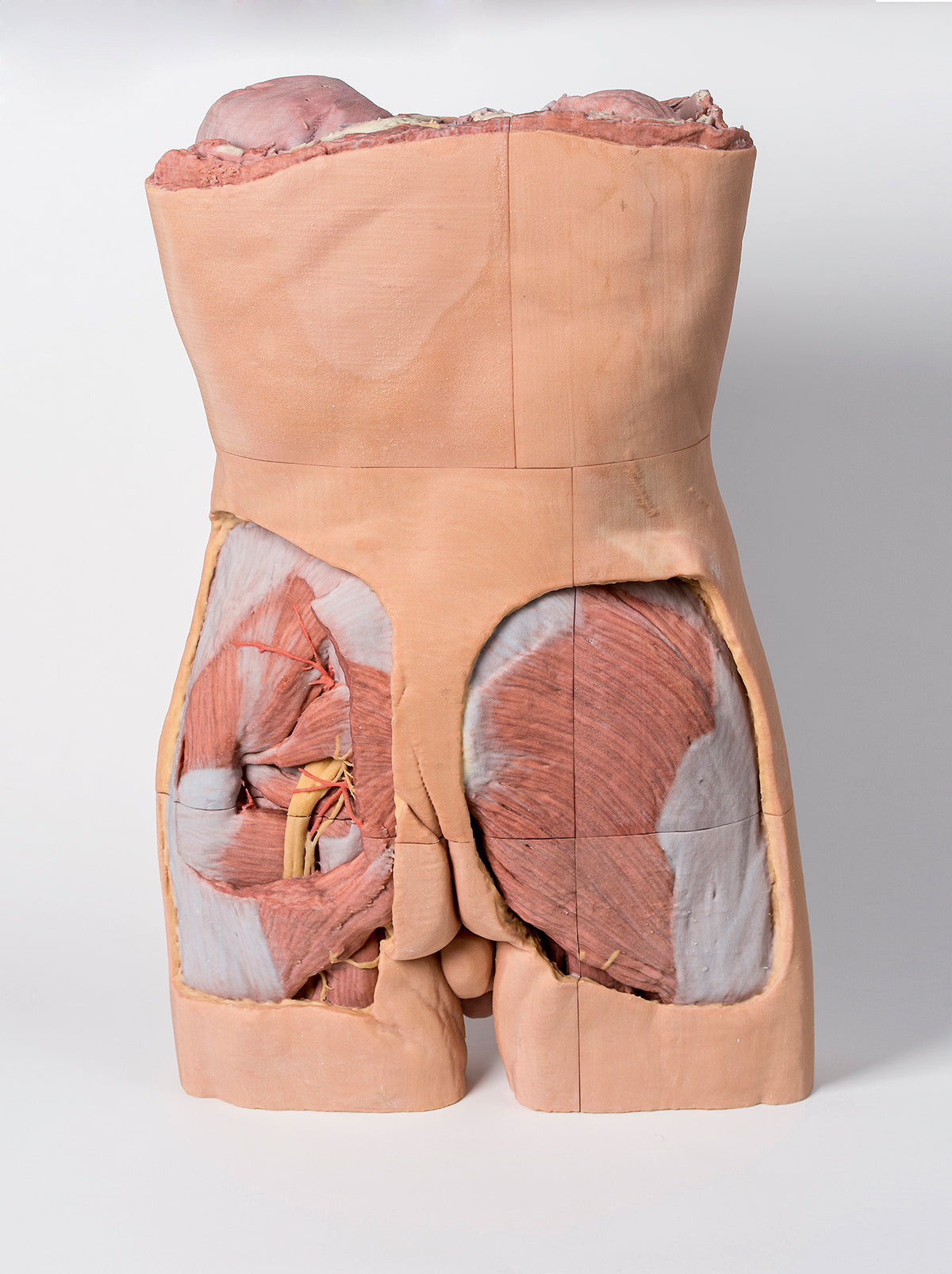 Posterior Abdominal wall