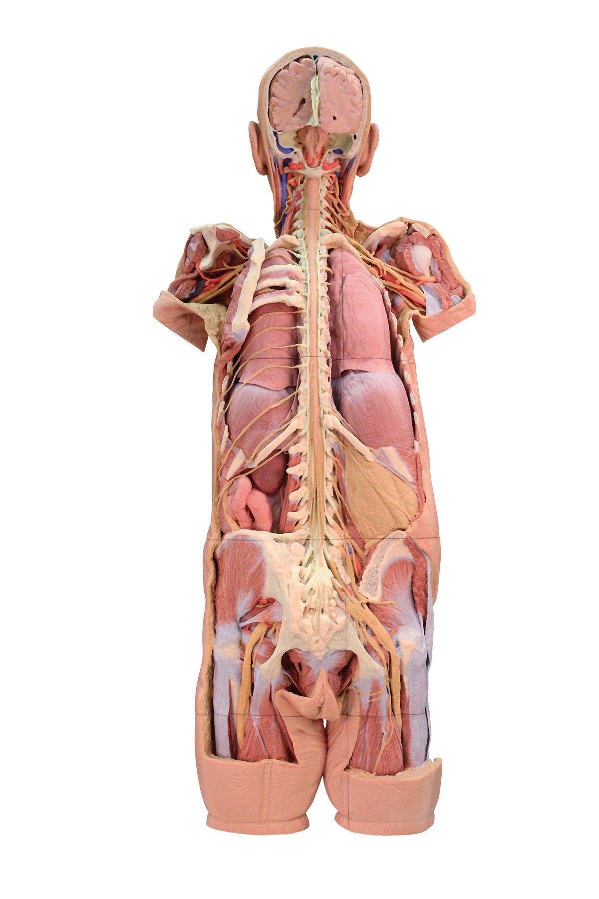 Nervous System Dissection (posterior view)