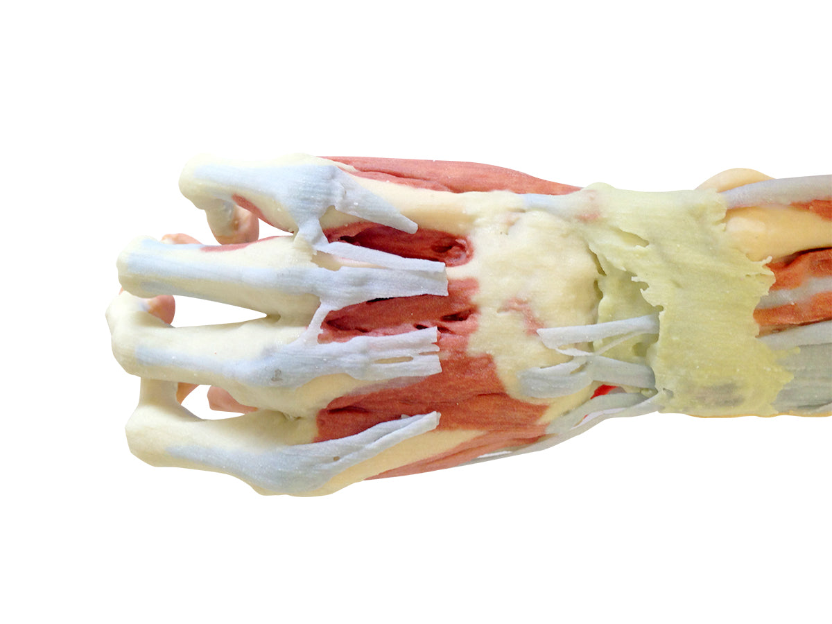 Deep upper limb and hand