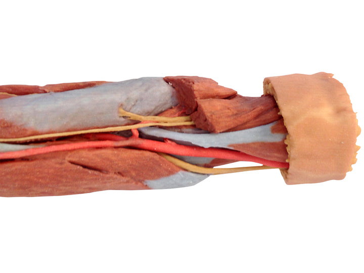 Deep upper limb and hand