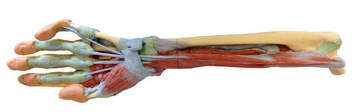 Forearm and hand - deep dissection