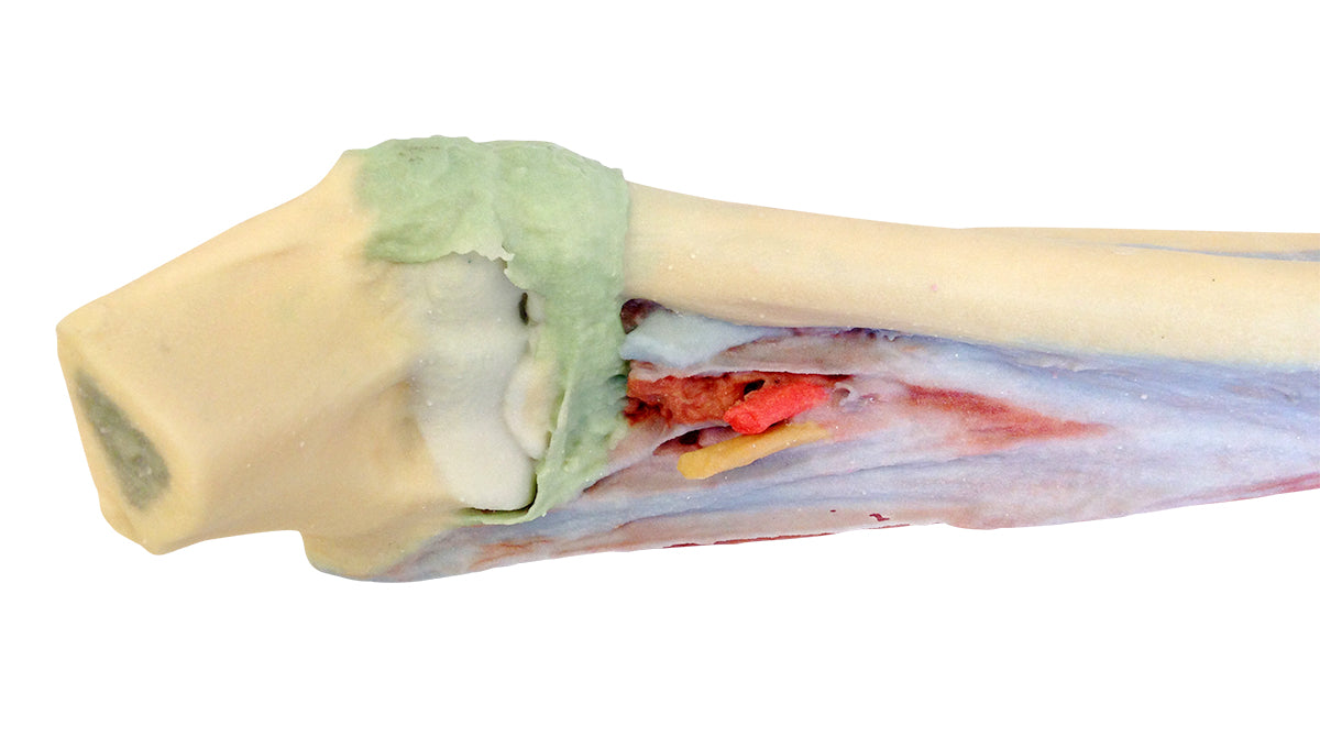 Forearm and hand - deep dissection