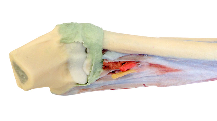 Forearm and hand - deep dissection