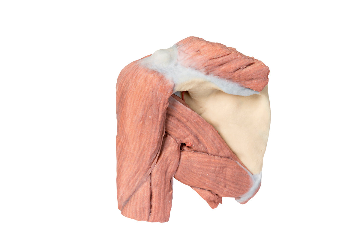 Shoulder (left) - Superficial muscles and axillary/brachial artery