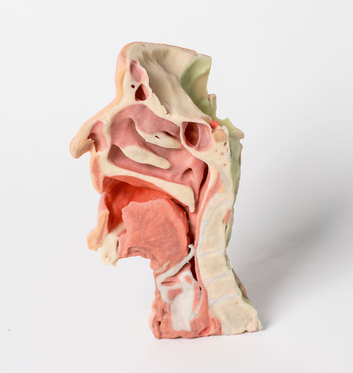 Deep face/Infratemporal fossa