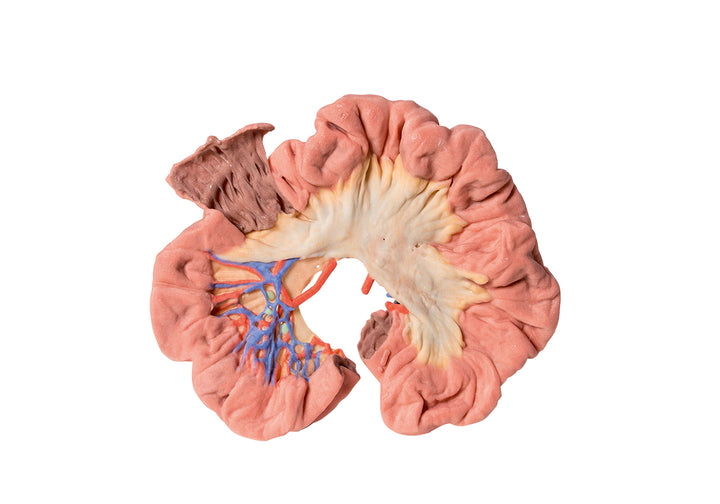 Bowel - Portion of Ileum