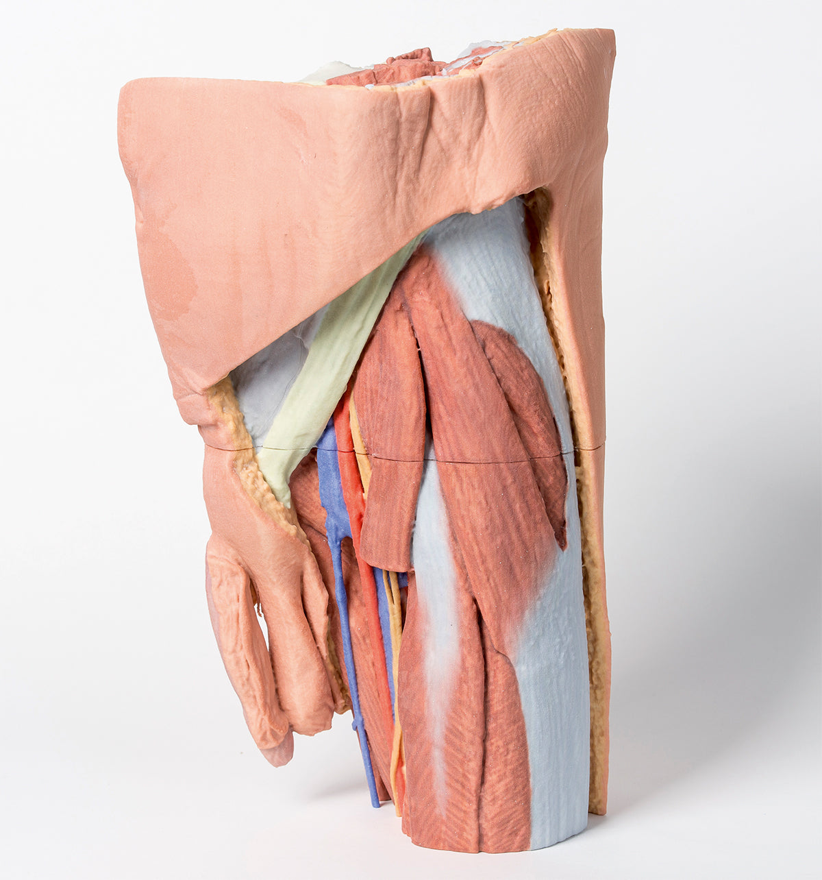 Male left pelvis and proximal thigh