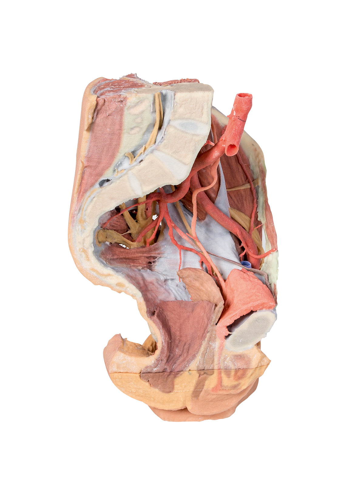 Female left pelvis and proximal thigh