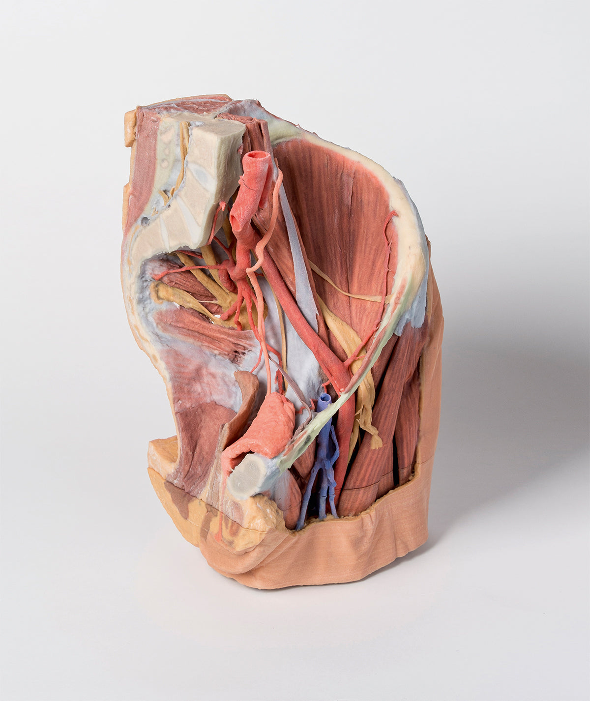 Female left pelvis and proximal thigh