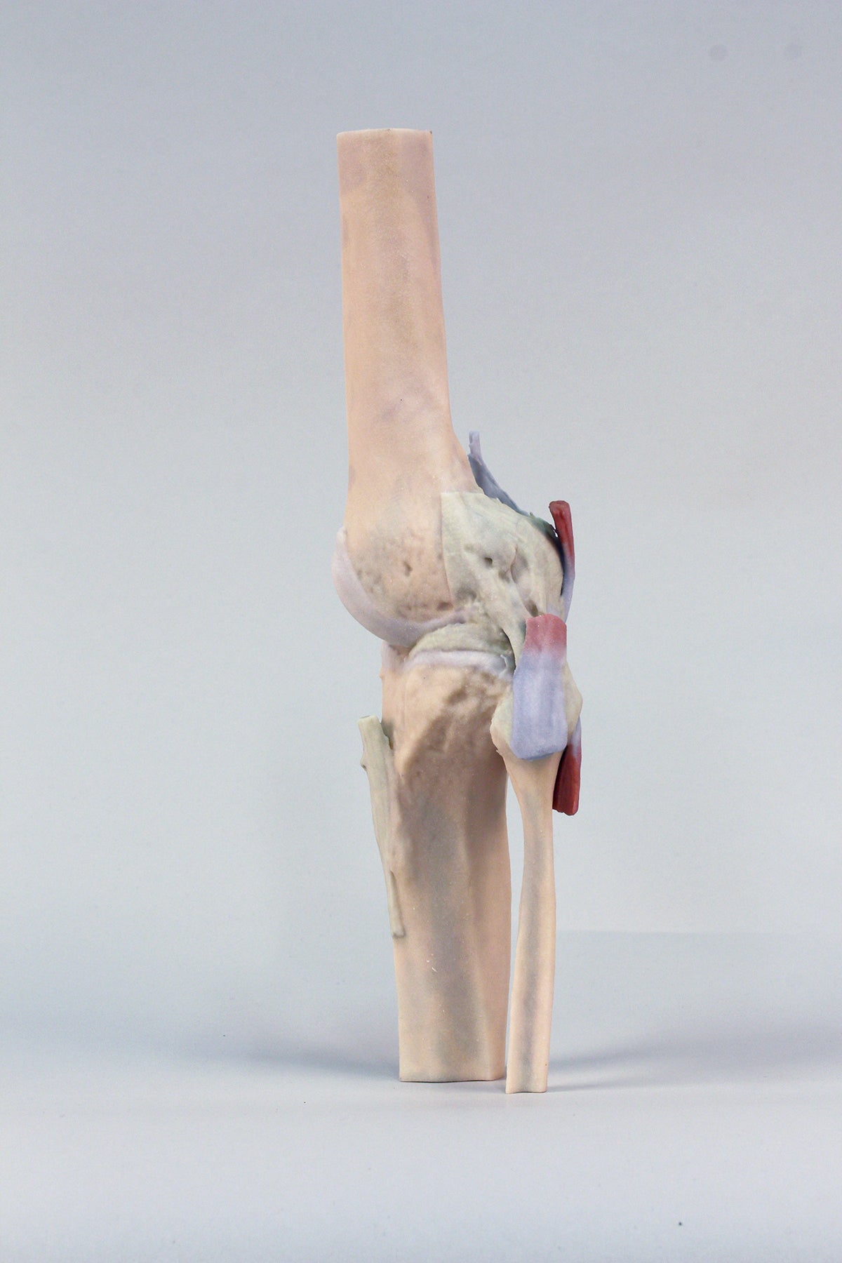 Knee Joint, extended
