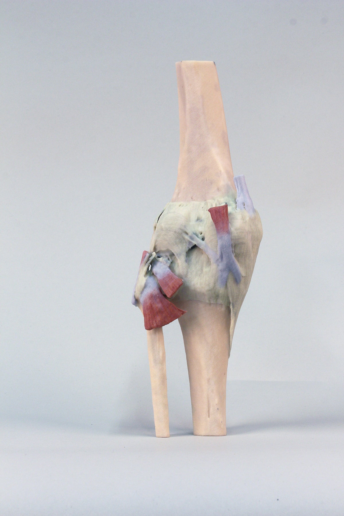 Knee Joint, extended
