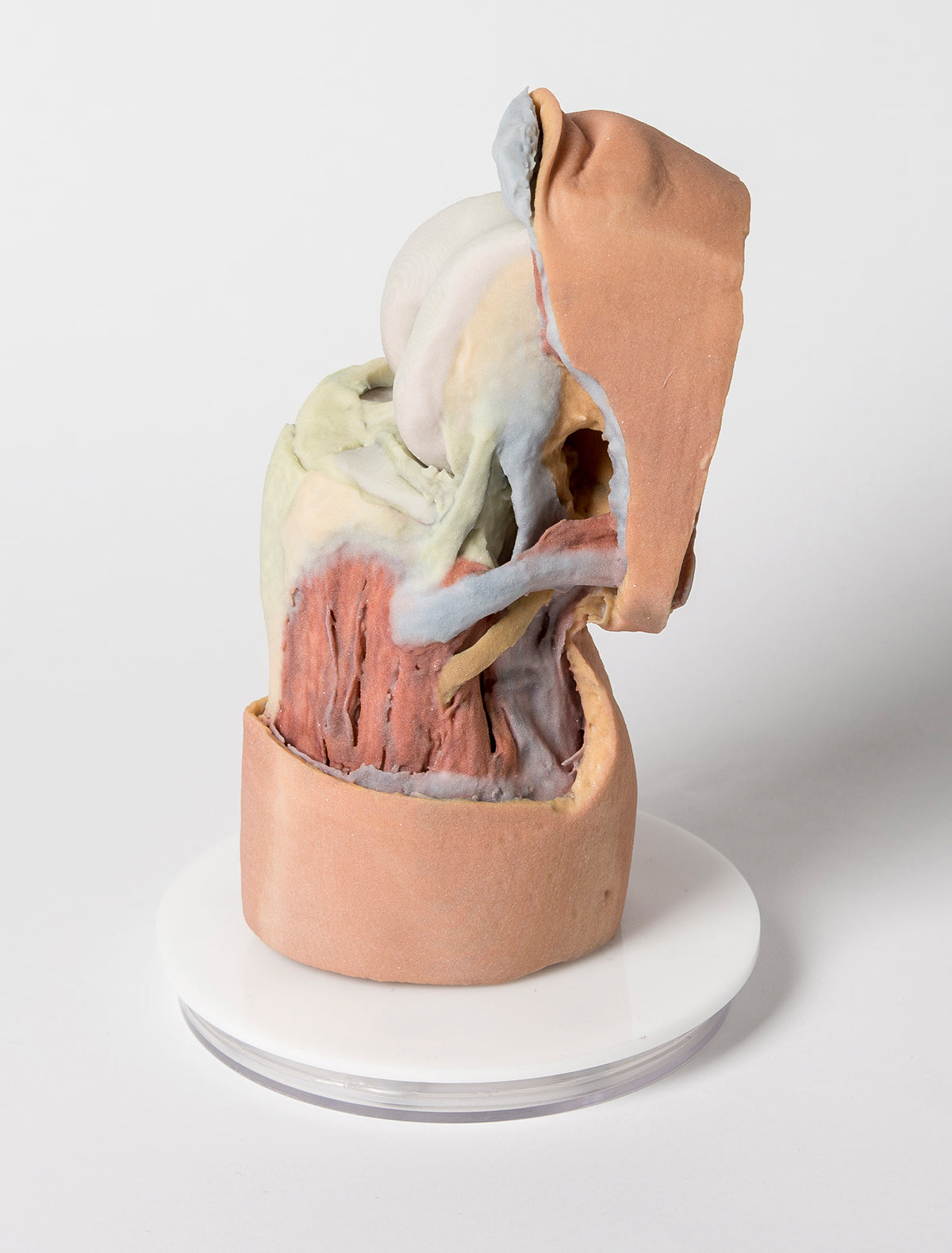 Flexed knee joint deep dissection
