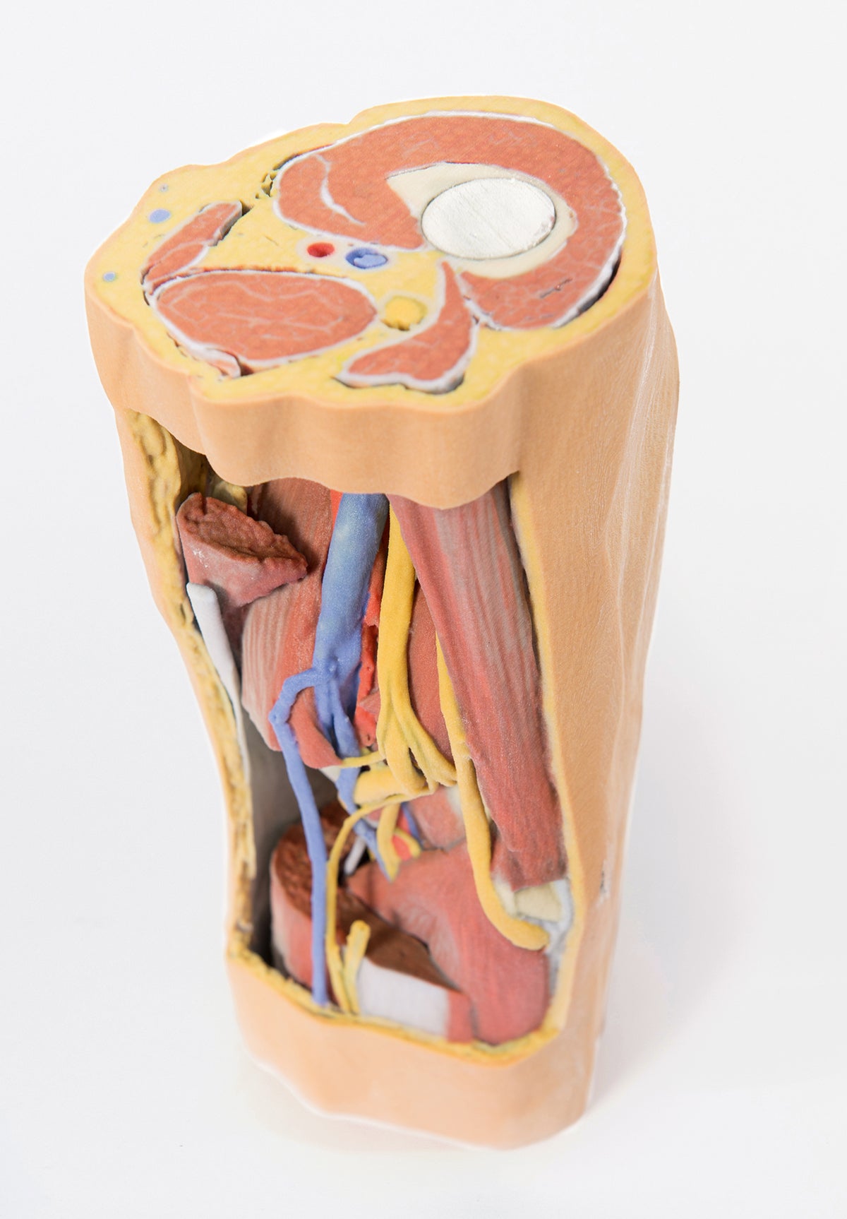 Popliteal Fossa distal thigh and proximal leg