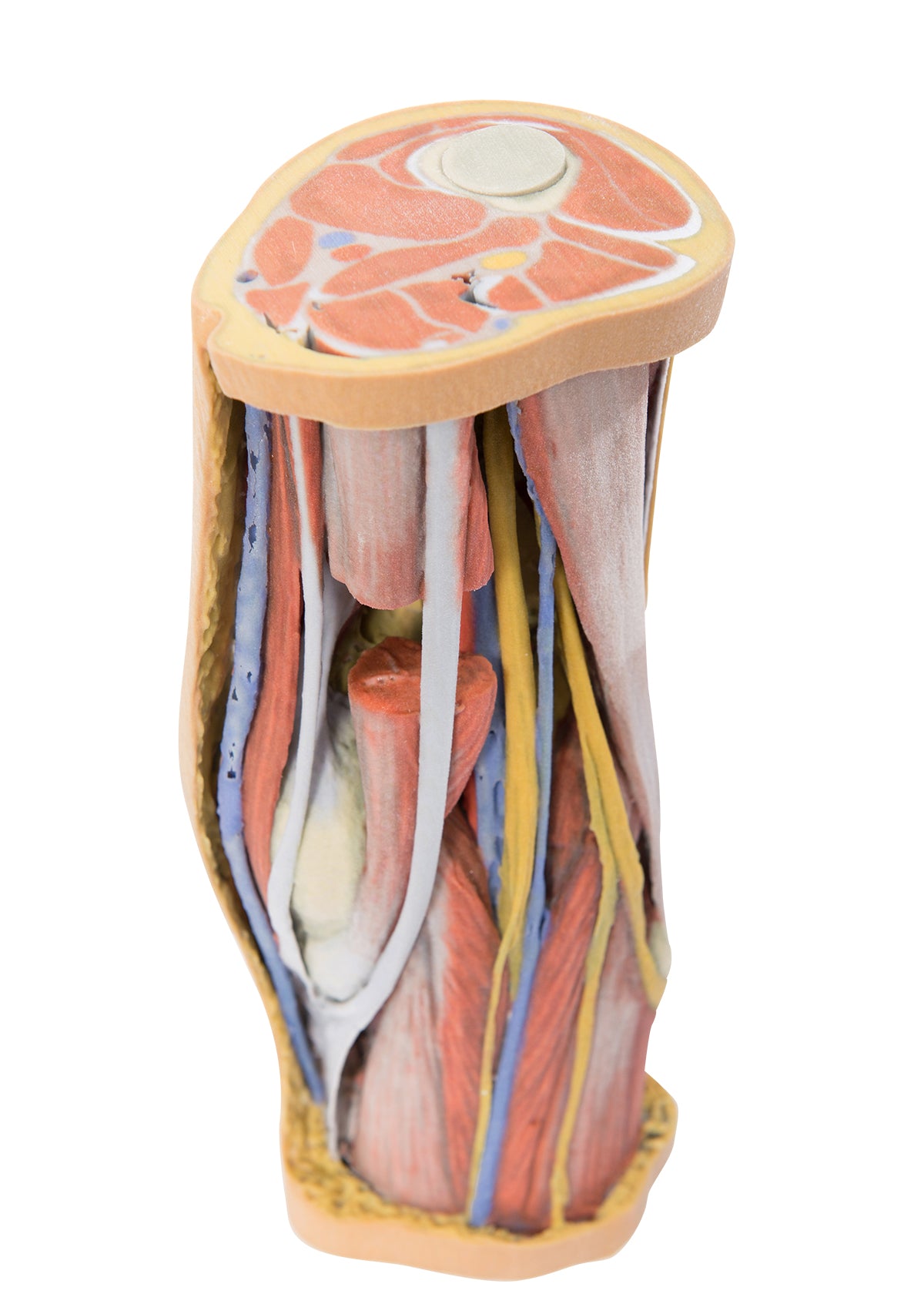 Popliteal Fossa