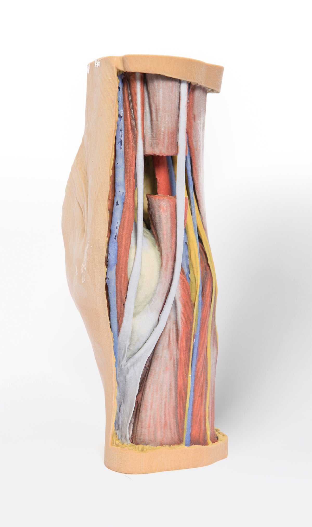 Popliteal Fossa