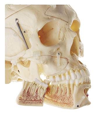 Somso Artificial Demonstration Skull of an Adult QS 8/11-S