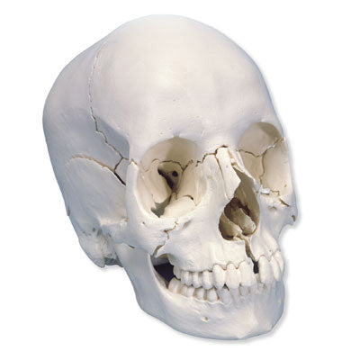 3B Beauchene Skull anatomical version 22-part