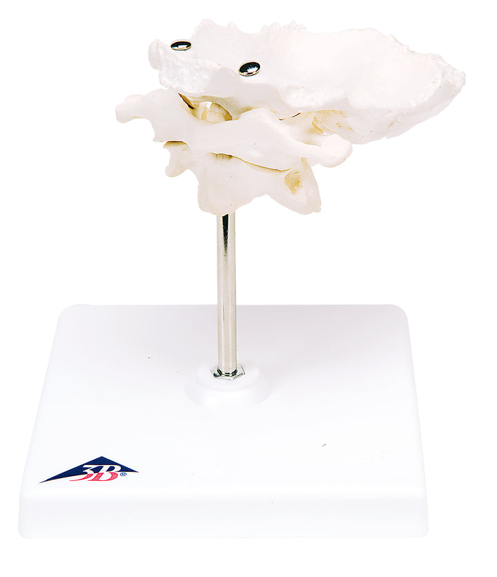 3B Atlas and Axis w/ Occipital Plate on stand