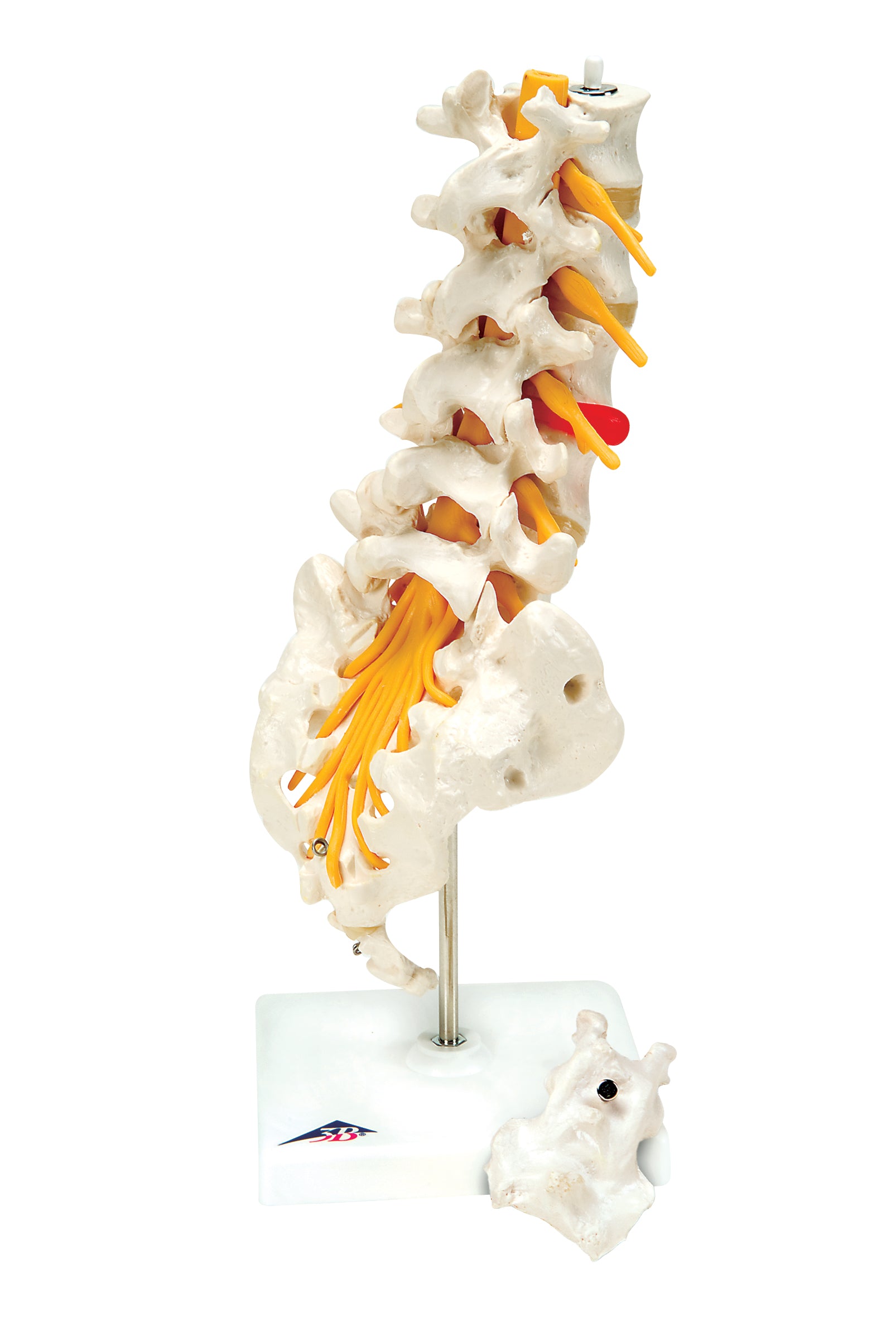 3B Lumbar Spinal Column w/ Dorso-Lateral Prolapsed Disc