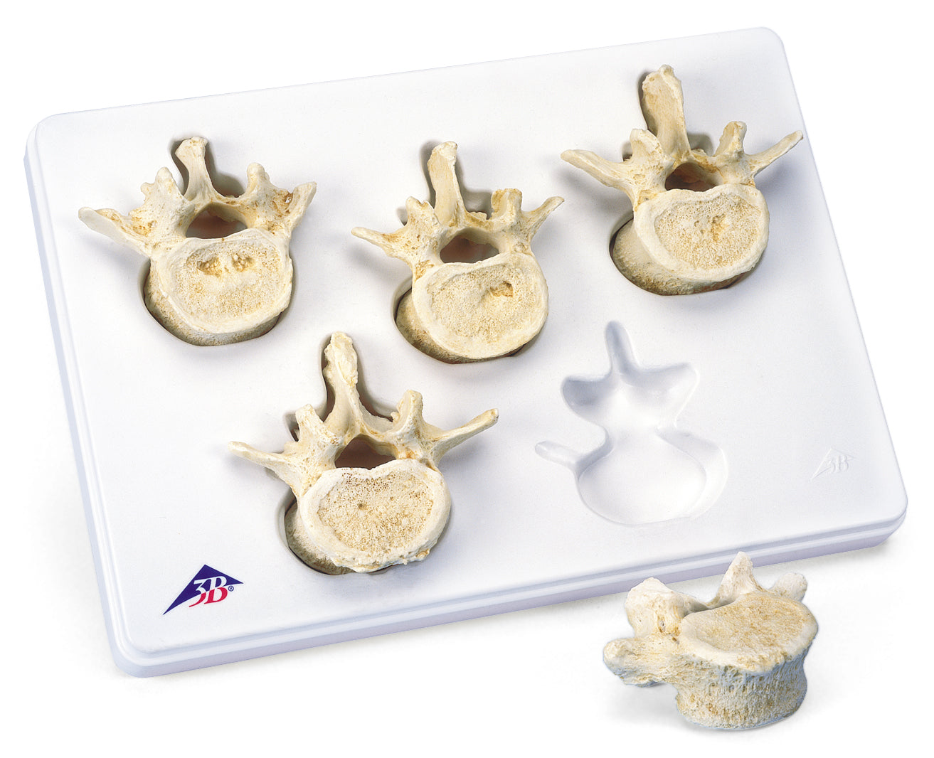 3B Set of 5 Lumbar Vertebrae