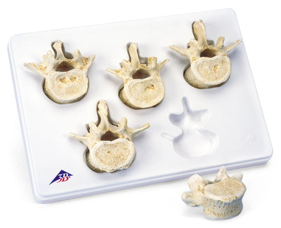 Vertebra Models