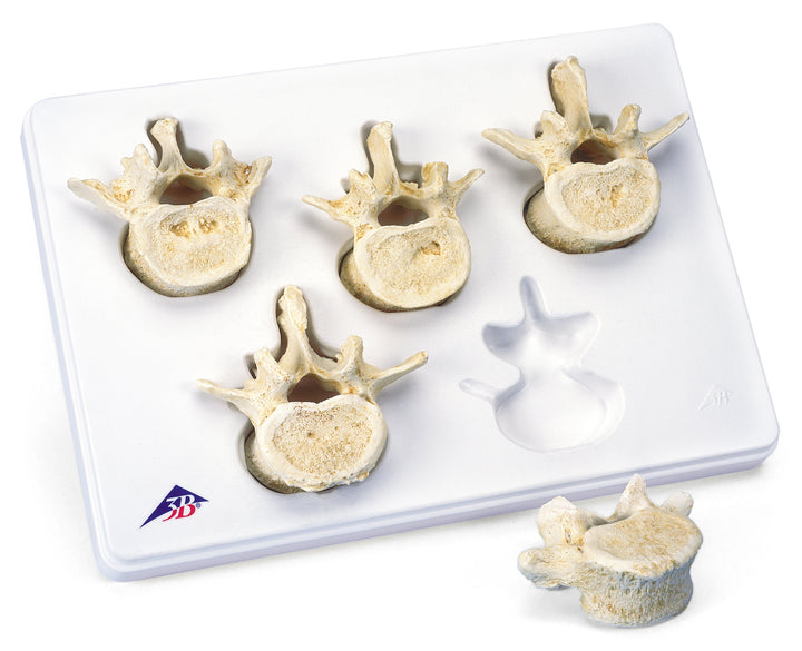 3B Set of 5 Lumbar Vertebrae