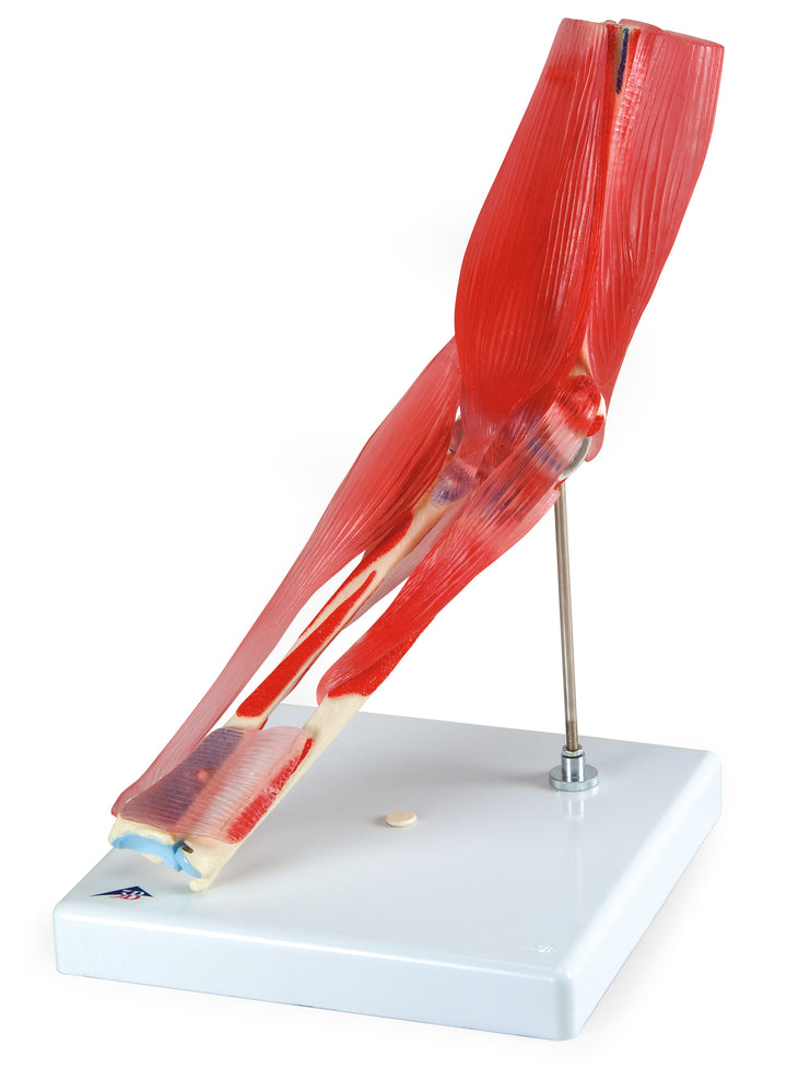 3B Elbow Joint 8 part