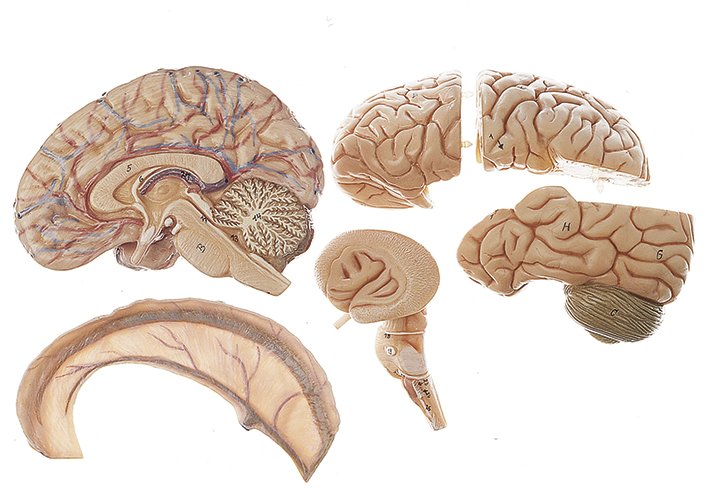SOMSO Model of Brain