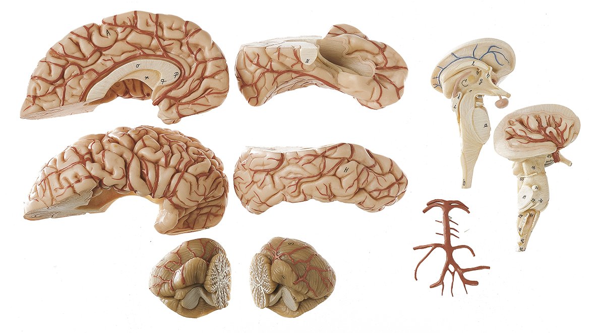 SOMSO Brain with Arteries