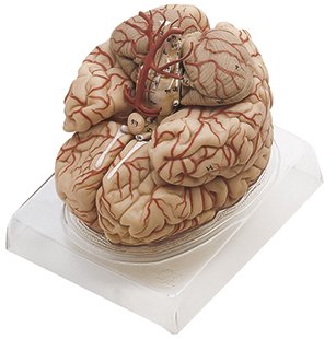 SOMSO Brain with Arteries