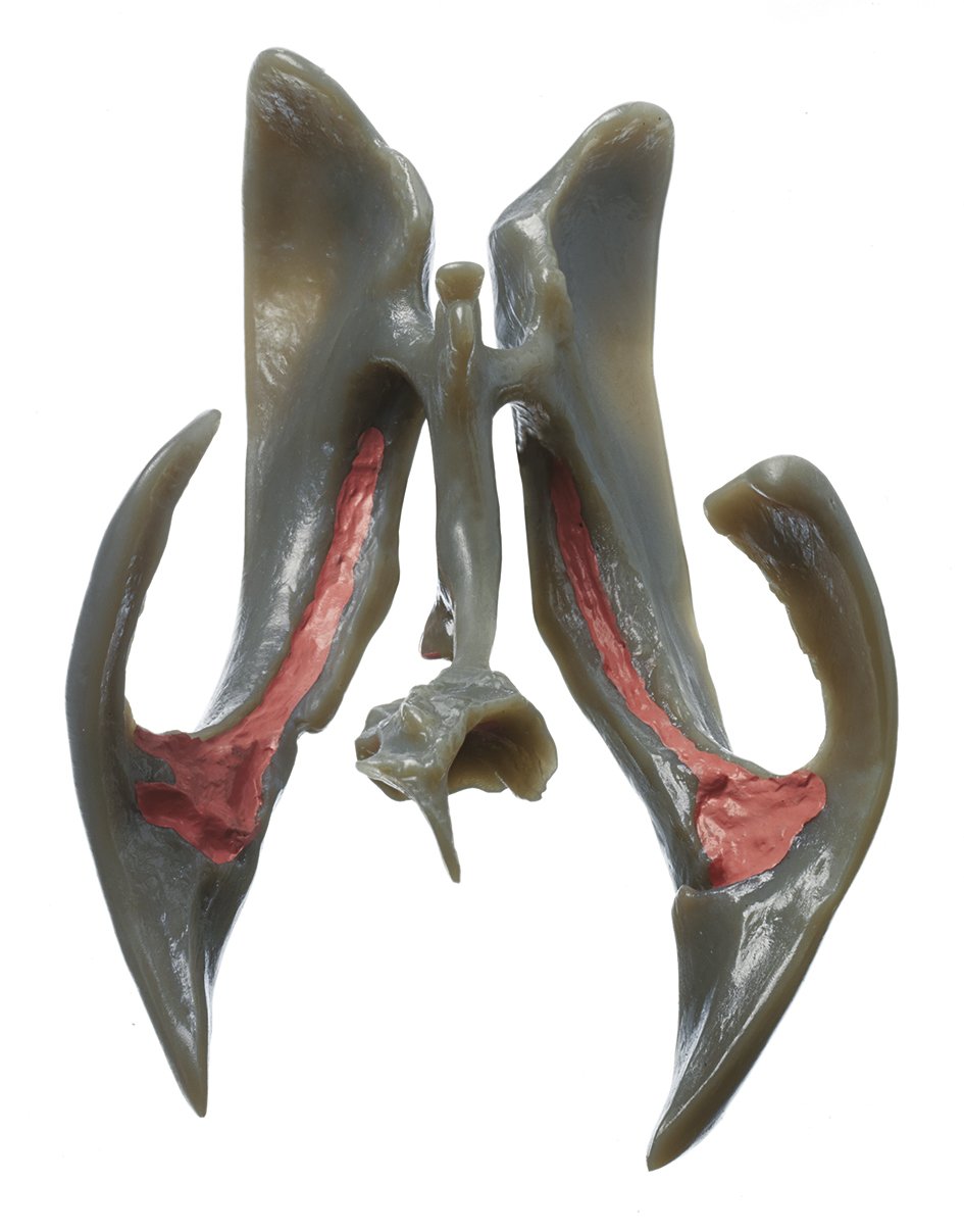 SOMSO Ventricular Cavities of the Brain