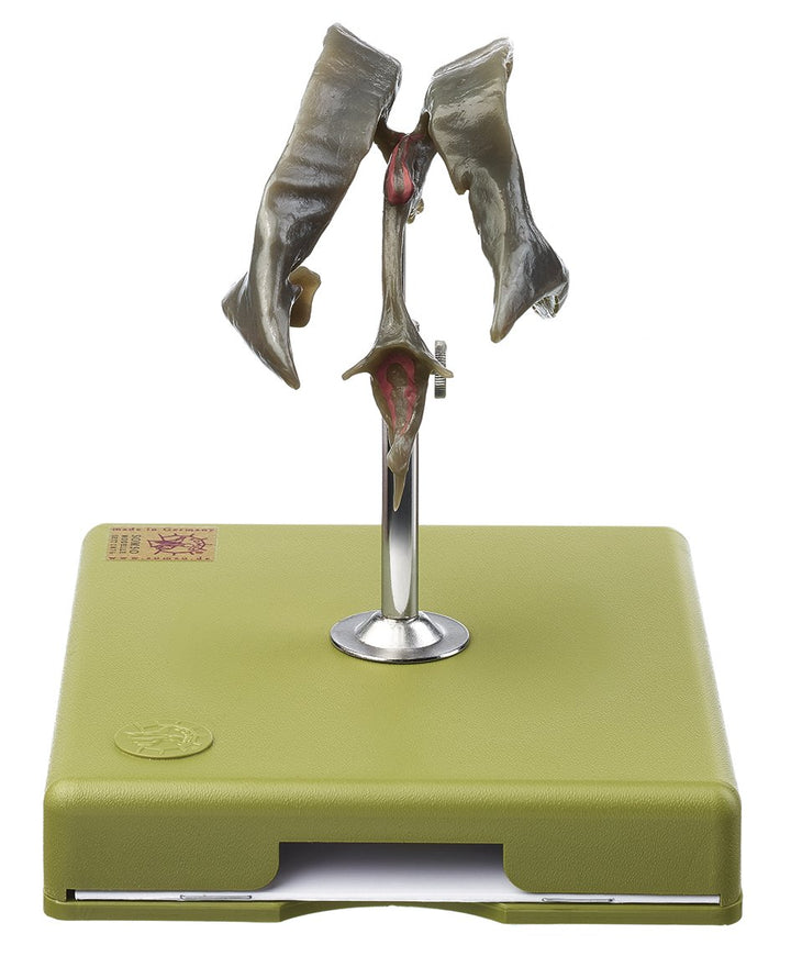 SOMSO Ventricular Cavities of the Brain