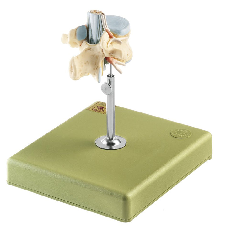 SOMSO Lumbar Vertebra (L II) with Lumbar Region of Spinal Cord