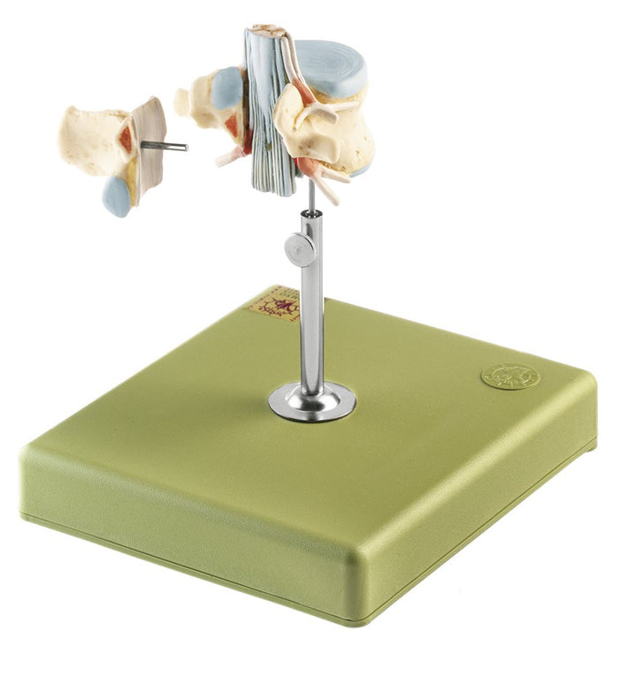 SOMSO Lumbar Vertebra (L II) with Lumbar Region of Spinal Cord